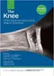 The Knee: AANA Advanced Arthroscopic Surgical Techniques
