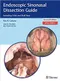 Endoscopic Sinonasal Dissection Guide: Including Orbit and Skull Base