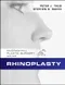 Rhinoplasty