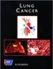 Lung Cancer with CD-ROM