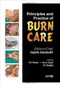 Principles and Practice of Burn Care