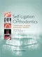 Self-Ligation in Orthodontics