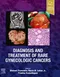 Diagnosis and Treatment of Rare Gynecologic Cancers