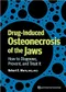 *Drug-Induced Osteonecrosis of the Jaws: How to Diagnose,Prevent,and Treat It