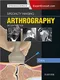 Specialty Imaging: Arthrography