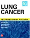 Lung Cancer: Standards of Care (IE)
