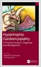 Hypertrophic Cardiomyopathy: A Practical Guide to Diagnosis and Management