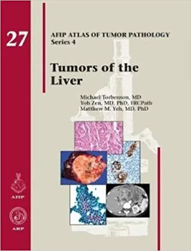 Tumors of the Liver 27 (AFIP Atlas of Tumor Pathology, Series 4)