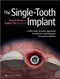 The Single-Tooth Implant: A Minimally Invasive Approach for Anterior and Posterior Extraction Socket
