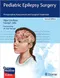 *Pediatric Epilepsy Surgery: Preoperative Assessment and Surgical Treatment