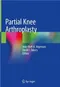Partial Knee Arthroplasty