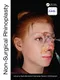 Non-Surgical Rhinoplasty