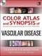 Color Atlas and Synopsis of Vascular Disease with DVD