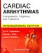 Cardiac Arrhythmias: Interpretation, Diagnosis and Treatment (IE)