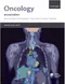 Oxford Core Text: Oncology