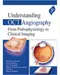 *Understanding OCT Angiography From Pathophysiology to Clinical Imaging