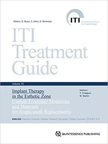 ITI Treatment Guide Vol.10: Implant Therapy in the Esthetic Zone