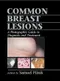 Common Breast Lesions: A Photographic Guide to Diagnosis and Treatment