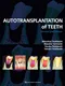 *Autotransplantation of Teeth (Revised)