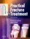 Practical Fracture Treatment (IE)