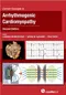 Current Concepts in Arrhythmogenic Cardiomyopathy