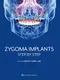 Zygoma Implants: Step by Step