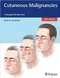 *Cutaneous Malignancies: A Surgical Perspective