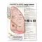 Understanding Lung Cancer Anatomical Chart Paper Unmounted