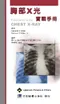 胸部X光實戰手冊(Field Guide to Chest X-Ray)