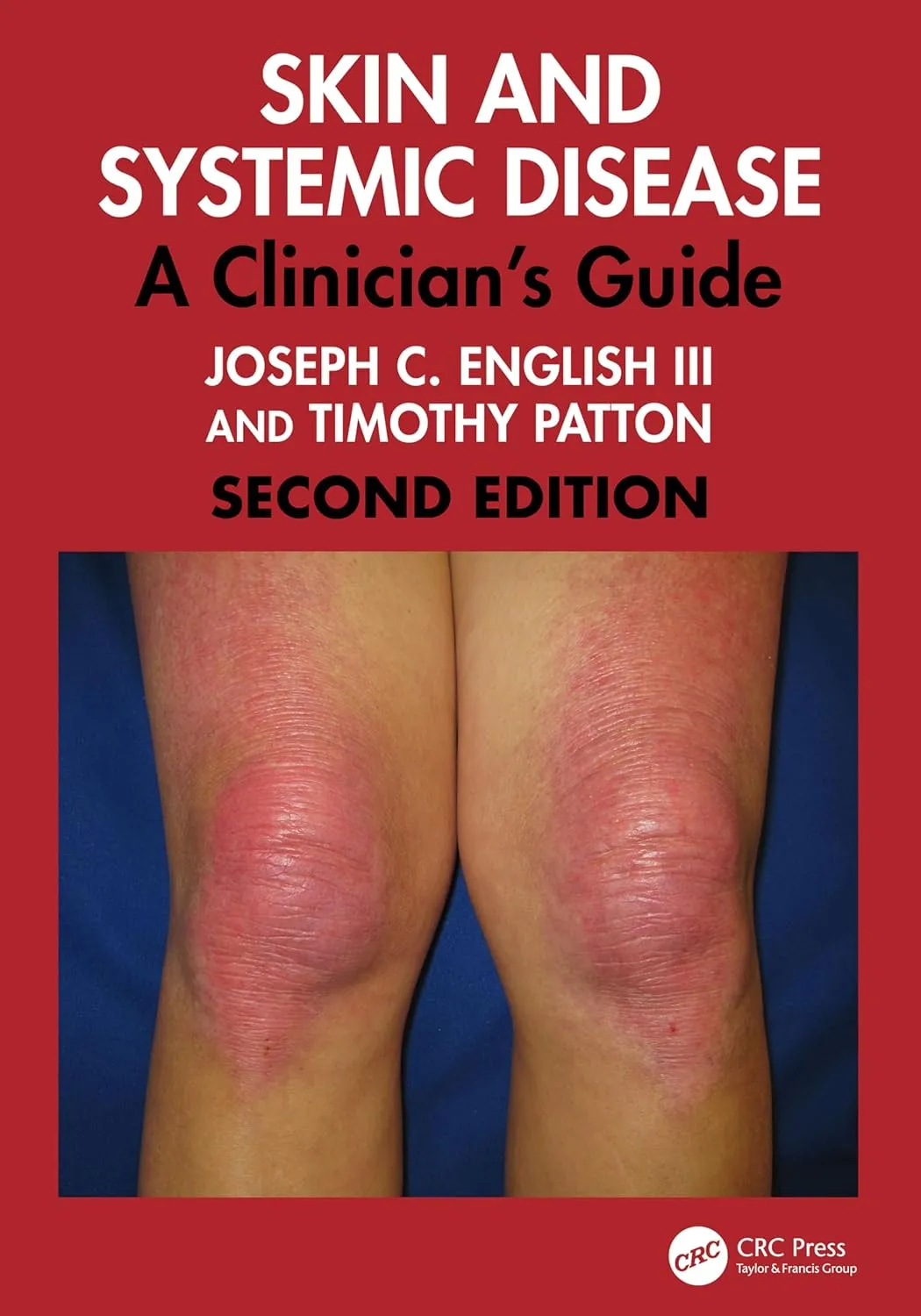 Skin and Systemic Disease: A Clinician's Guide
