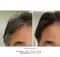 韓國 LA PITTA 白髮專用補髮染髮劑 局部暫時性 補染劑 染髮劑 攜帶型 10ml【和泰美妝】