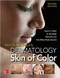 Taylor and Kelly\s Dermatology for Skin of Color