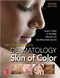(舊版特價-恕不退換)Taylor and Kelly\s Dermatology for Skin of Color