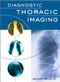 Diagnostic Thoracic Imaging