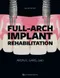 Full-Arch Implant Rehabilitation