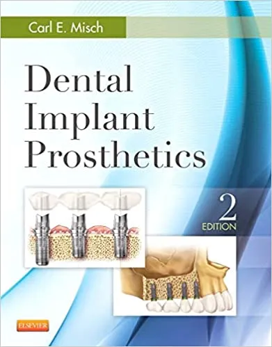 DENTAL PROSTHETICS IMPLANT インプラント補綴