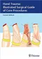 Hand Trauma: Illustrated Surgical Guide of Core Procedures