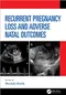 Recurrent Pregnancy Loss and Adverse Natal Outcomes