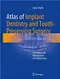 *Atlas of Implant Dentistry and Tooth-Preserving Surgery: Prevention and Management of Complications
