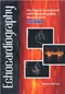 Echocardiography: The Normal Examination of Echocardiographic Measurements