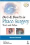 Do's & Don'ts in Phaco Surgery: Text and Atlas