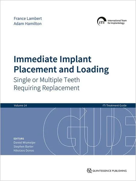 【裁断済み】ITI Treatment Guide Volume1〜14 +α ITI Treatment Guide Vol.14: Immediate Implant Placement and