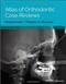 Atlas of Orthodontic Case Reviews