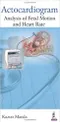 Actocardiogram: Analysis of Fetal Motion and Heart Rate