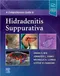 (書況不佳-請電洽)A Comprehensive Guide to Hidradenitis Suppurativa
