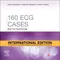 160 ECG Cases (IE)