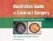 Illustrative Guide to Cataract Surgery: A Step-by-Step Approach to Refining Surgical Skills