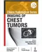 Clinico Radiological Series: Imaging of Chest Tumors