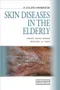 A Color Handbook: Skin Diseases in the Elderly