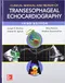 Clinical Manual and Review of Transesophageal Echocardiography